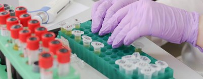 EU4Health: aperto il bando EU FAB